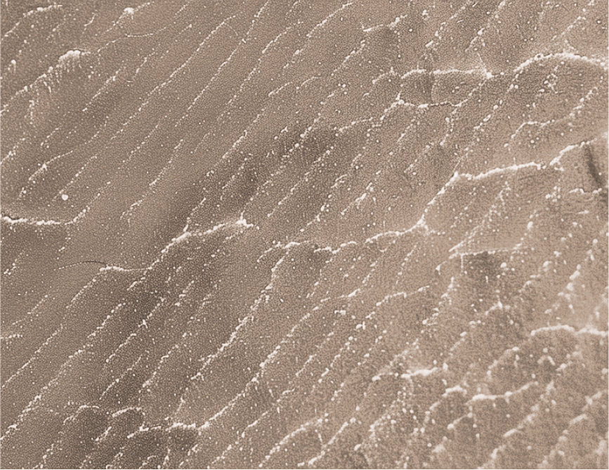 dry skin